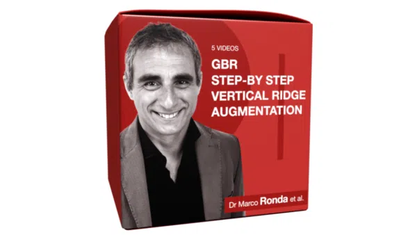 EDIBLE GBR Step-by Step Vertical Ridge Augmentation in 5 Videos | Ronda & Sanciu