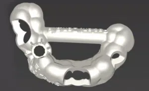How to make a surgical guide in CDX and provisionals in Cares